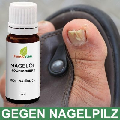 Fungustan Nagelöl – Optimal bei Fuß- oder Nagelpilz
